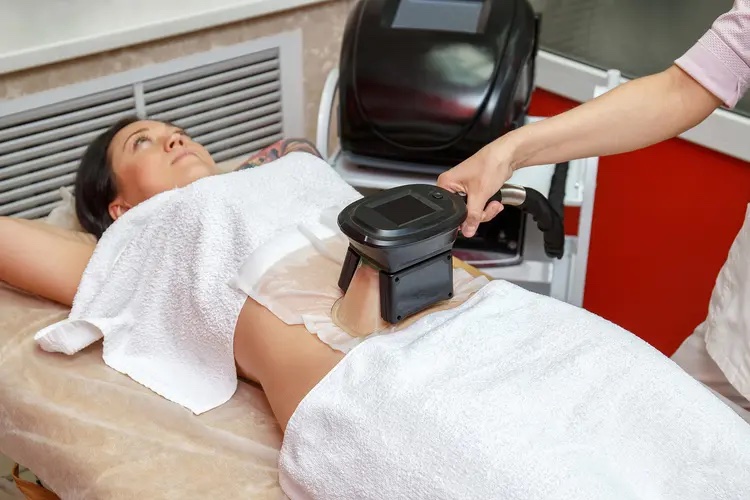 CoolSculpting applicator positioned on a client's abdomen during a cryolipolysis session at Sculpted Body Curves